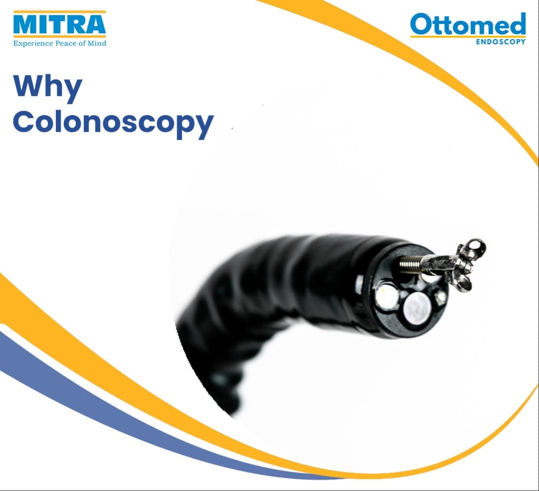 How Colonoscopy helps in early screening of Bowel cancer